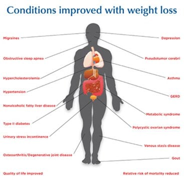 Conditions improved with weight loss